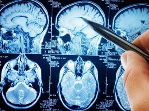 استخدام متخصص جراحی مغز و اعصاب در عمان