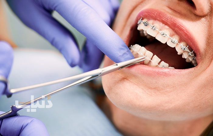 سهم بیمه دندان پزشکی در ترکیه